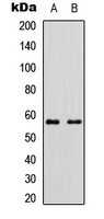 CYP11B2 / Aldosterone Synthase Antibody - Western blot analysis of Cytochrome P450 11B2 expression in HEK293T (A); Raw264.7 (B) whole cell lysates.