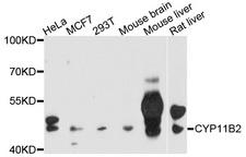 CYP11B2 / Aldosterone Synthase Antibody - Western blot analysis of extracts of various cell lines, using CYP11B2 antibody at 1:1000 dilution. The secondary antibody used was an HRP Goat Anti-Rabbit IgG (H+L) at 1:10000 dilution. Lysates were loaded 25ug per lane and 3% nonfat dry milk in TBST was used for blocking. An ECL Kit was used for detection and the exposure time was 20s.