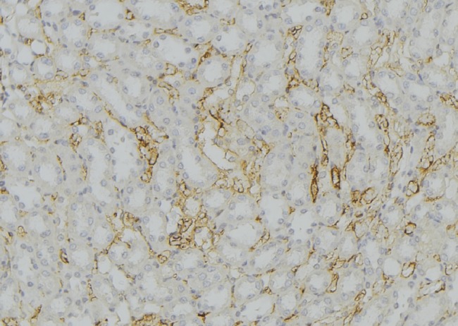 CYP11B2 / Aldosterone Synthase Antibody - 1:100 staining mouse kidney tissue by IHC-P. The sample was formaldehyde fixed and a heat mediated antigen retrieval step in citrate buffer was performed. The sample was then blocked and incubated with the antibody for 1.5 hours at 22°C. An HRP conjugated goat anti-rabbit antibody was used as the secondary.