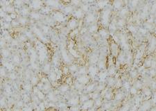 CYP11B2 / Aldosterone Synthase Antibody - 1:100 staining mouse kidney tissue by IHC-P. The sample was formaldehyde fixed and a heat mediated antigen retrieval step in citrate buffer was performed. The sample was then blocked and incubated with the antibody for 1.5 hours at 22°C. An HRP conjugated goat anti-rabbit antibody was used as the secondary.