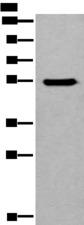 CYP11B2 / Aldosterone Synthase Antibody - Western blot analysis of HEPG2 cell lysate  using CYP11B2 Polyclonal Antibody at dilution of 1:650