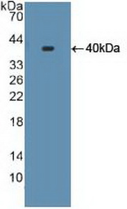 CYP17 / CYP17A1 Antibody - Western Blot; Sample: Recombinant S17aH, Human.