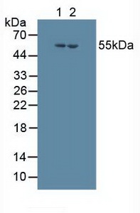 CYP17 / CYP17A1 Antibody - Western Blot; Sample: Lane1: Human HepG2 Cells; Lane2: Human Jurkat Cells.
