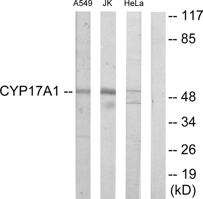 CYP17 / CYP17A1 Antibody - Western blot analysis of lysates from Jurkat, A549, and HeLa cells, using Cytochrome P450 17A1 Antibody. The lane on the right is blocked with the synthesized peptide.