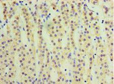 CYP17 / CYP17A1 Antibody - Immunohistochemistry of paraffin-embedded human adrenal gland using antibody at 1:100 dilution.