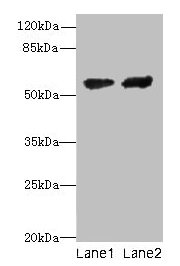 CYP17 / CYP17A1 Antibody - Western blot All lanes: Steroid 17-alpha-hydroxylase/17, 20 lyase antibody at 12µg/ml Lane 1: Hela whole cell lysate Lane 2: A549 whole cell lysate Secondary Goat polyclonal to rabbit IgG at 1/10000 dilution Predicted band size: 57 kDa Observed band size: 57 kDa