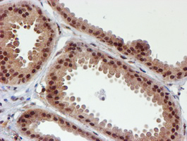 CYP17 / CYP17A1 Antibody - IHC of paraffin-embedded Human breast tissue using anti-CYP17A1 mouse monoclonal antibody. (Heat-induced epitope retrieval by 10mM citric buffer, pH6.0, 100C for 10min).