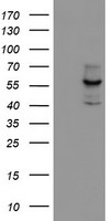 CYP17 / CYP17A1 Antibody - HEK293T cells were transfected with the pCMV6-ENTRY control (Left lane) or pCMV6-ENTRY CYP17A1 (Right lane) cDNA for 48 hrs and lysed. Equivalent amounts of cell lysates (5 ug per lane) were separated by SDS-PAGE and immunoblotted with anti-CYP17A1.