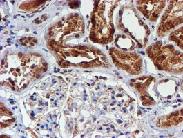 CYP17 / CYP17A1 Antibody - IHC of paraffin-embedded Human Kidney tissue using anti-CYP17A1 mouse monoclonal antibody. (Heat-induced epitope retrieval by 10mM citric buffer, pH6.0, 100C for 10min).