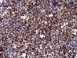 CYP17 / CYP17A1 Antibody - IHC of paraffin-embedded Human Ovary tissue using anti-CYP17A1 mouse monoclonal antibody. (Heat-induced epitope retrieval by 10mM citric buffer, pH6.0, 100C for 10min).