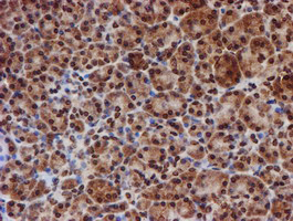 CYP17 / CYP17A1 Antibody - IHC of paraffin-embedded Human pancreas tissue using anti-CYP17A1 mouse monoclonal antibody. (Heat-induced epitope retrieval by 10mM citric buffer, pH6.0, 100C for 10min).