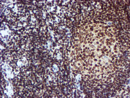 CYP17 / CYP17A1 Antibody - IHC of paraffin-embedded Human tonsil using anti-CYP17A1 mouse monoclonal antibody. (Heat-induced epitope retrieval by 10mM citric buffer, pH6.0, 100C for 10min).