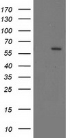 CYP17 / CYP17A1 Antibody - HEK293T cells were transfected with the pCMV6-ENTRY control (Left lane) or pCMV6-ENTRY CYP17A1 (Right lane) cDNA for 48 hrs and lysed. Equivalent amounts of cell lysates (5 ug per lane) were separated by SDS-PAGE and immunoblotted with anti-CYP17A1.