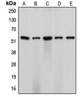 CYP17 / CYP17A1 Antibody - Western blot analysis of Cytochrome P450 17A1 expression in HeLa (A); NIH3T3 (B); H9C2 (C); SW13 (D); ES2 (E) whole cell lysates.