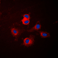 CYP17 / CYP17A1 Antibody - Immunofluorescent analysis of Cytochrome P450 17A1 staining in NIH3T3 cells. Formalin-fixed cells were permeabilized with 0.1% Triton X-100 in TBS for 5-10 minutes and blocked with 3% BSA-PBS for 30 minutes at room temperature. Cells were probed with the primary antibody in 3% BSA-PBS and incubated overnight at 4 C in a humidified chamber. Cells were washed with PBST and incubated with a DyLight 594-conjugated secondary antibody (red) in PBS at room temperature in the dark. DAPI was used to stain the cell nuclei (blue).