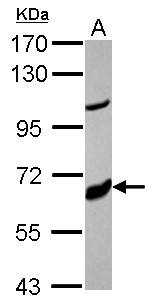 CYP17 / CYP17A1 Antibody - Sample (30 ug of whole cell lysate) A: MCF-7 7.5% SDS PAGE CYP17A1 antibody diluted at 1:10000