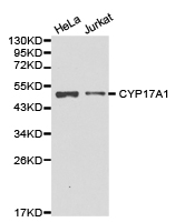 CYP17 / CYP17A1 Antibody - Western blot of extracts of various cell lines, using CYP17A1 antibody.
