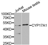 CYP17 / CYP17A1 Antibody - Western blot analysis of extracts of various cells.