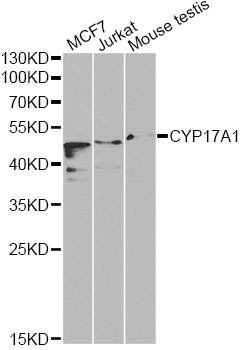 CYP17 / CYP17A1 Antibody - Western blot analysis of extracts of various cell lines, using CYP17A1 antibody at 1:1000 dilution. The secondary antibody used was an HRP Goat Anti-Rabbit IgG (H+L) at 1:10000 dilution. Lysates were loaded 25ug per lane and 3% nonfat dry milk in TBST was used for blocking. An ECL Kit was used for detection.