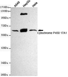 CYP17 / CYP17A1 Antibody - Western blot detection of Cytochrome P450 17A1 in HeLa, HepG2 and A549 cell lysates using Cytochrome P450 17A1 mouse monoclonal antibody (1:1000 dilution). Predicted band size: 60KDa. Observed band size:60KDa.