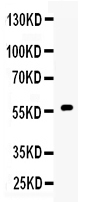 CYP17 / CYP17A1 Antibody - Western blot - Anti-CYP17A1/Cytochrome P450 17A1 Picoband Antibody