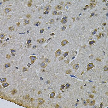 CYP17 / CYP17A1 Antibody - Immunohistochemistry of paraffin-embedded rat brain using CYP17A1 Antibody at dilution of 1:100 (40x lens).