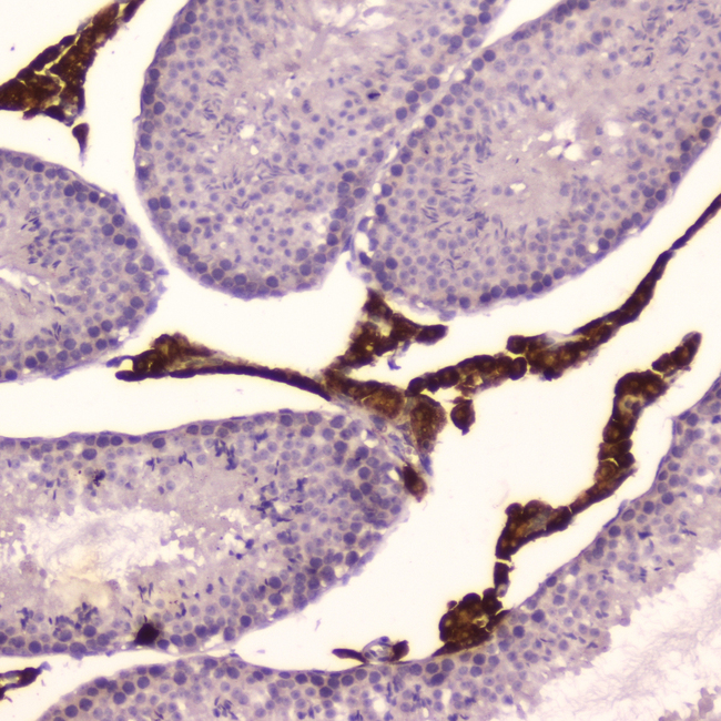 CYP17 / CYP17A1 Antibody - IHC analysis of Cyp17a1 using anti-Cyp17a1 antibody. Cyp17a1 was detected in paraffin-embedded section of mouse testis tissue . Heat mediated antigen retrieval was performed in citrate buffer (pH6, epitope retrieval solution) for 20 mins. The tissue section was blocked with 10% goat serum. The tissue section was then incubated with 2?g/ml rabbit anti-Cyp17a1 Antibody overnight at 4?C. Biotinylated goat anti-rabbit IgG was used as secondary antibody and incubated for 30 minutes at 37?C. The tissue section was developed using Strepavidin-Biotin-Complex (SABC) with DAB as the chromogen.