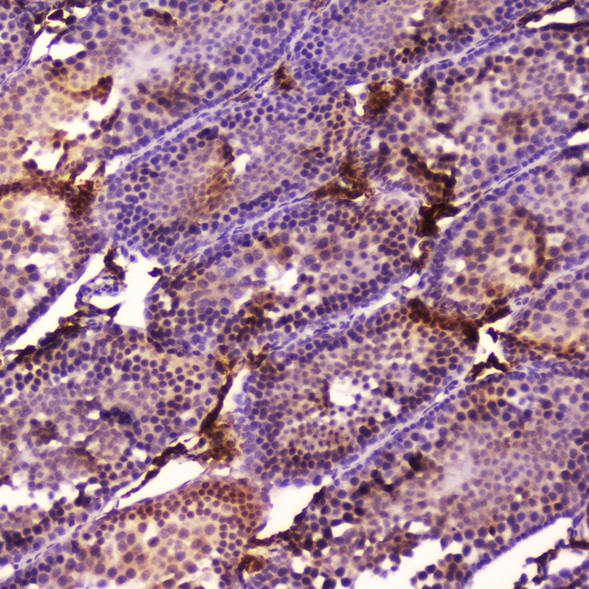 CYP17 / CYP17A1 Antibody - IHC analysis of Cyp17a1 using anti-Cyp17a1 antibody. Cyp17a1 was detected in paraffin-embedded section of rat testis tissue . Heat mediated antigen retrieval was performed in citrate buffer (pH6, epitope retrieval solution) for 20 mins. The tissue section was blocked with 10% goat serum. The tissue section was then incubated with 2?g/ml rabbit anti-Cyp17a1 Antibody overnight at 4?C. Biotinylated goat anti-rabbit IgG was used as secondary antibody and incubated for 30 minutes at 37?C. The tissue section was developed using Strepavidin-Biotin-Complex (SABC) with DAB as the chromogen.