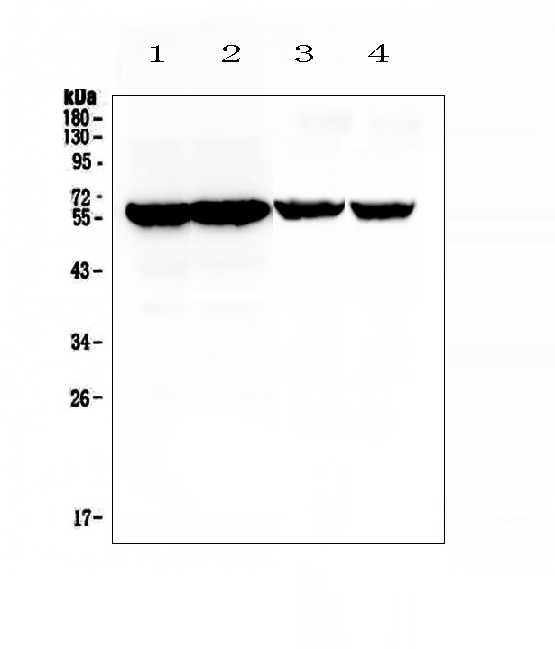 CYP17 / CYP17A1 Antibody - Western blot analysis of Cyp17a1 using anti-Cyp17a1 antibody. Electrophoresis was performed on a 5-20% SDS-PAGE gel at 70V (Stacking gel) / 90V (Resolving gel) for 2-3 hours. The sample well of each lane was loaded with 50ug of sample under reducing conditions. Lane 1: mouse testis tissue lysates, Lane 2: mouse testis tissue lysates, Lane 3: rat testis tissue lysates, Lane 4: rat testis tissue lysates. After Electrophoresis, proteins were transferred to a Nitrocellulose membrane at 150mA for 50-90 minutes. Blocked the membrane with 5% Non-fat Milk/ TBS for 1.5 hour at RT. The membrane was incubated with rabbit anti-Cyp17a1 antigen affinity purified polyclonal antibody at 0.5 ?g/mL overnight at 4?C, then washed with TBS-0.1% Tween 3 times with 5 minutes each and probed with a goat anti-rabbit IgG-HRP secondary antibody at a dilution of 1:10000 for 1.5 hour at RT. The signal is developed using an Enhanced Chemiluminescent detection (ECL) kit with Tanon 5200 system. A specific band was detected for Cyp17a1 at approximately 57KD. The expected band size for Cyp17a1 is at 57KD.