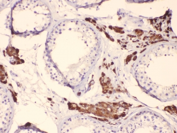 CYP17 / CYP17A1 Antibody - IHC testing of FFPE human testis tissue with CYP17A1 antibody. HIER: steam section in pH6 citrate buffer for 20 min.