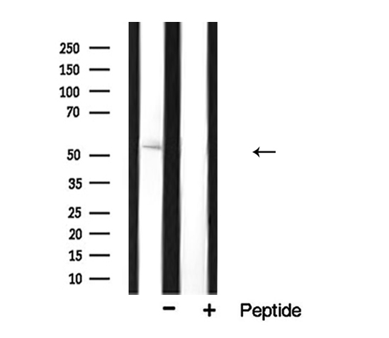 CYP17 / CYP17A1 Antibody - Western blot analysis of Cytochrome P450 17A1 expression in mouse tissue.