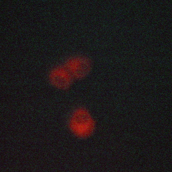 CYP17 / CYP17A1 Antibody - Staining LOVO cells by IF/ICC. The samples were fixed with PFA and permeabilized in 0.1% saponin prior to blocking in 10% serum for 45 min at 37°C. The primary antibody was diluted 1/400 and incubated with the sample for 1 hour at 37°C. A Alexa Fluor® 594 conjugated goat polyclonal to rabbit IgG (H+L), diluted 1/600 was used as secondary antibody.
