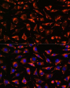 CYP17 / CYP17A1 Antibody - Immunofluorescence analysis of L929 cells using CYP17A1 Polyclonal Antibody at dilution of 1:100.Blue: DAPI for nuclear staining.