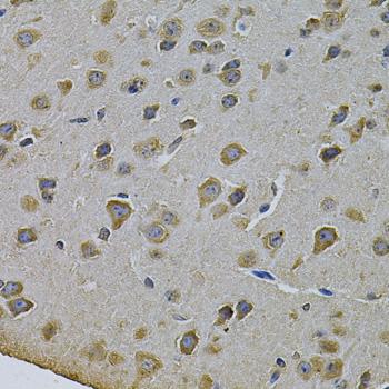 CYP17 / CYP17A1 Antibody - Immunohistochemistry of paraffin-embedded Rat brain using CYP17A1 Polyclonal Antibody at dilution of 1:100 (40x lens).