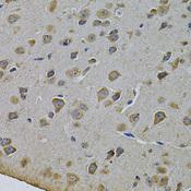 CYP17 / CYP17A1 Antibody - Immunohistochemistry of paraffin-embedded Rat brain using CYP17A1 Polyclonal Antibody at dilution of 1:100 (40x lens).