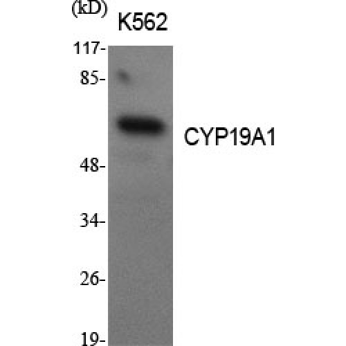 CYP19 / Aromatase Antibody - Western blot of CYP19A1 antibody