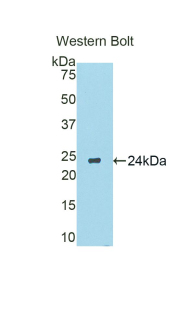 CYP19 / Aromatase Antibody - Western blot of recombinant CYP19 / Aromatase.  This image was taken for the unconjugated form of this product. Other forms have not been tested.