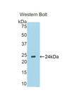 CYP19 / Aromatase Antibody - Western blot of recombinant CYP19 / Aromatase.  This image was taken for the unconjugated form of this product. Other forms have not been tested.