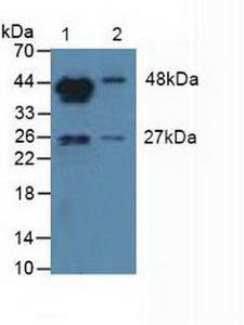 CYP19 / Aromatase Antibody - Western Blot; Sample: Lane1: Mouse Testis Tissue; Lane2: Mouse Placenta Tissue.
