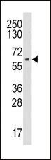 CYP19 / Aromatase Antibody - Western blot of anti-CYP19A1 antibody in HL60 cell line lysates (35 ug/lane). CYP19A1(arrow) was detected using the purified antibody.