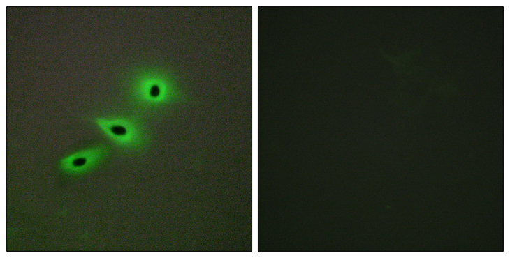 CYP19 / Aromatase Antibody - Immunofluorescence analysis of A549 cells, using Cytochrome P450 19A1 Antibody. The picture on the right is blocked with the synthesized peptide.