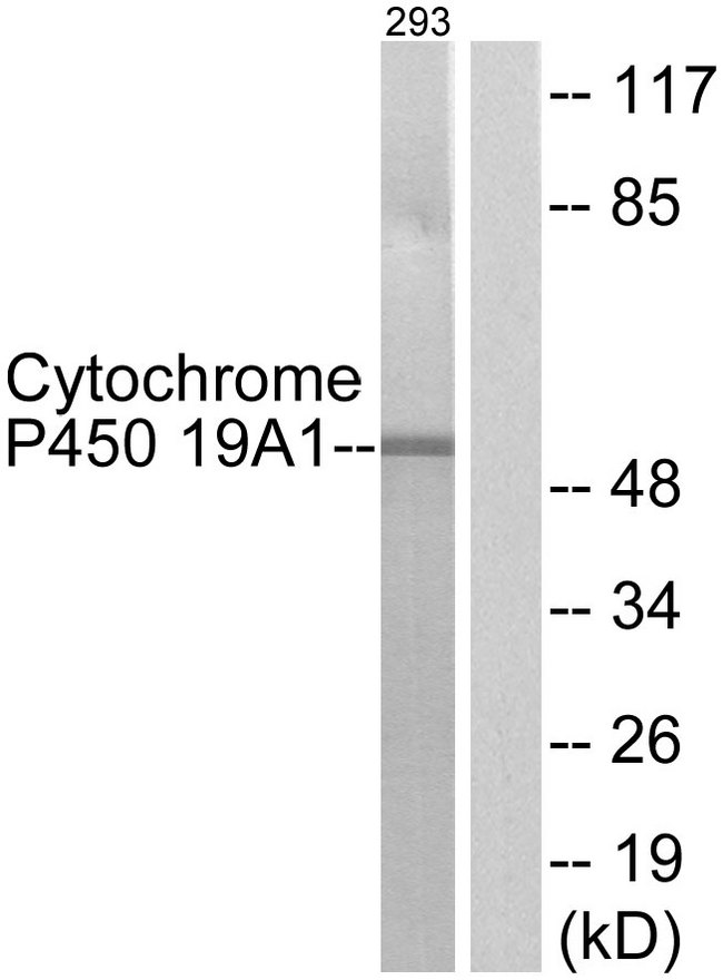 CYP19 / Aromatase Antibody - Western blot analysis of lysates from 293 cells, using Cytochrome P450 19A1 Antibody. The lane on the right is blocked with the synthesized peptide.