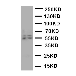 CYP19 / Aromatase Antibody - WB of CYP19 / Aromatase antibody. Lane 1: Human Placenta Tissue Lysate. Lane 2: Human Placenta Tissue Lysate.