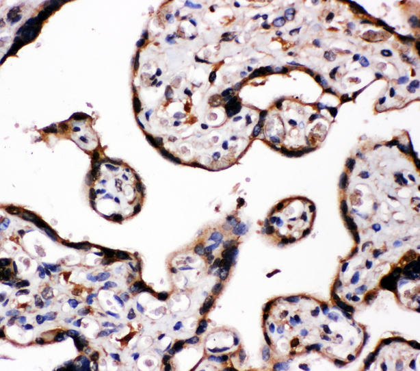 CYP19 / Aromatase Antibody - CYP19 / Aromatase antibody. IHC(P): Human Placenta Tissue.