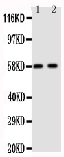 CYP19 / Aromatase Antibody - Anti-Aromatase antibody, Western blotting Lane 1: Human Placenta Tissue LysateLane 2: Human Placenta Tissue Lysate