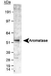CYP19 / Aromatase Antibody - Detection of aromatase in human fetal temporal lobe lysate. ECL exposure, 1-2 minutes.  This image was taken for the unconjugated form of this product. Other forms have not been tested.