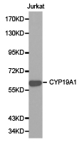 CYP19 / Aromatase Antibody - Western blot of extracts of Jurkat cell lines, using CYP19A1 antibody.