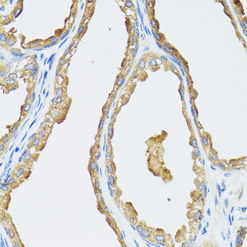CYP19 / Aromatase Antibody - Immunohistochemistry of paraffin-embedded human prostate tissue.