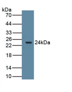 CYP19 / Aromatase Antibody - Western Blot Sample: Recombinant ARO, Rat