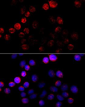 CYP19 / Aromatase Antibody - Immunofluorescence analysis of HeLa cells using CYP19A1 antibody at dilution of 1:100 (40x lens). Blue: DAPI for nuclear staining.